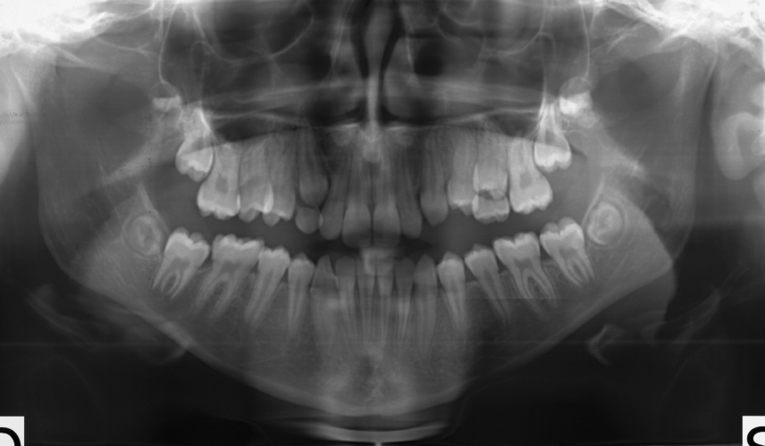 Diagnostica radiologica odontoiatrica in età evolutiva